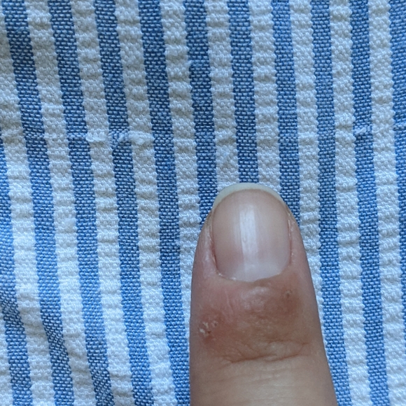 VTG Norma Kamali blue and white pinstripe seersucker blazer size large - Picture 9 of 11